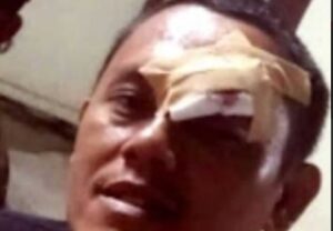 Oknum Kadis Karawang Sekap dan Aniaya Wartawan