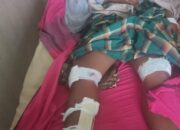 Keluarga  Korban  Dugaan  Penganiayaan  Melapor ke  Polres Binjai